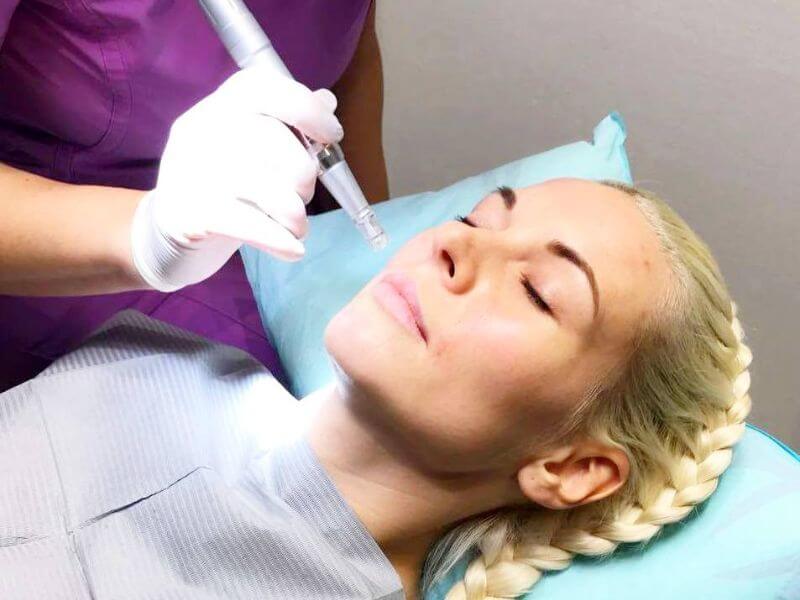 iPRF procedure | Dental Shop