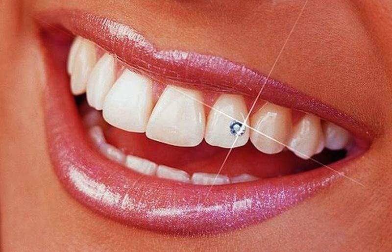Dental restoration | Dental Shop