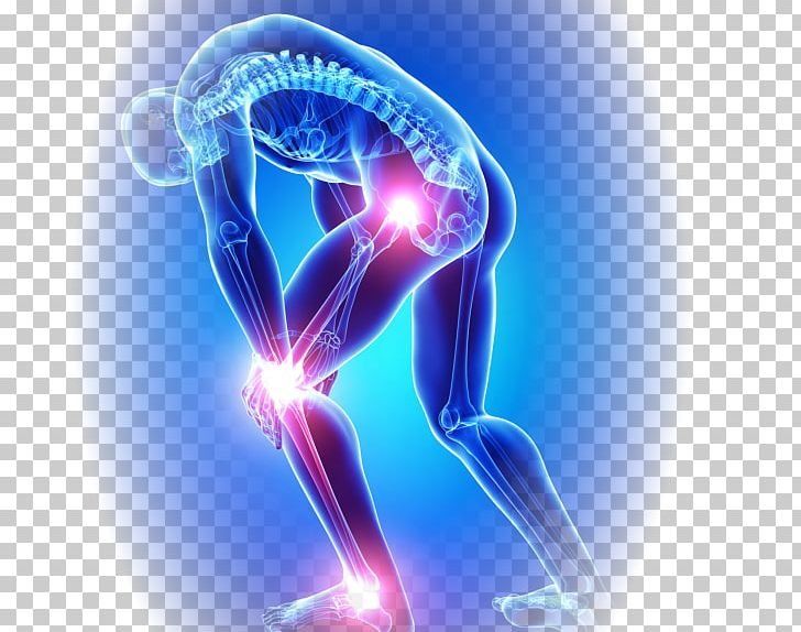 Arthritis, joint pain, natural, rheumatoid arthritis, hip pain, osteoarthritis, pain