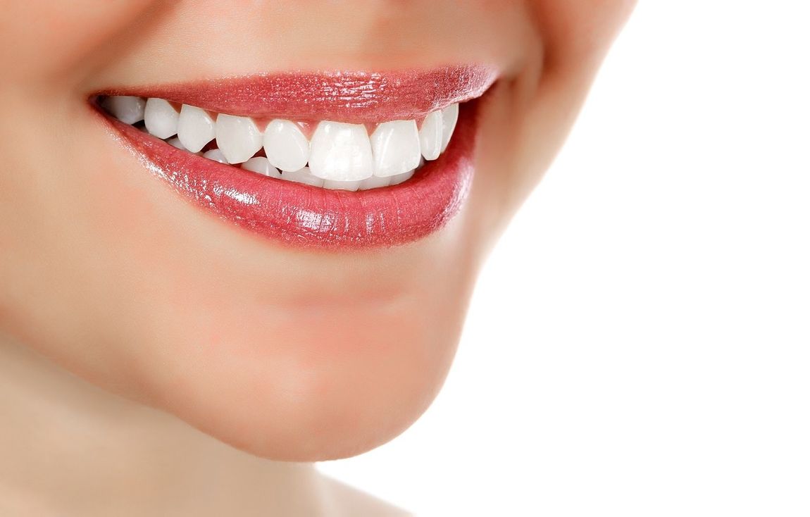 denti bianchi