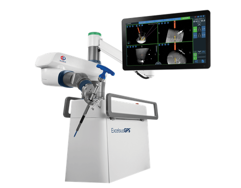 robotic surgery navigation screen