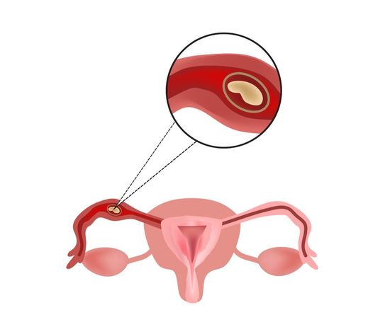 Utero
