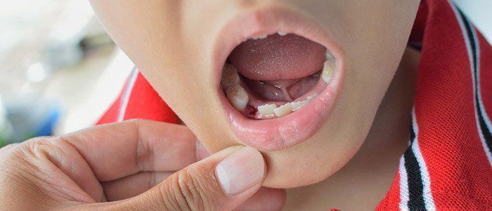 Doctor inspecting tooth extraction