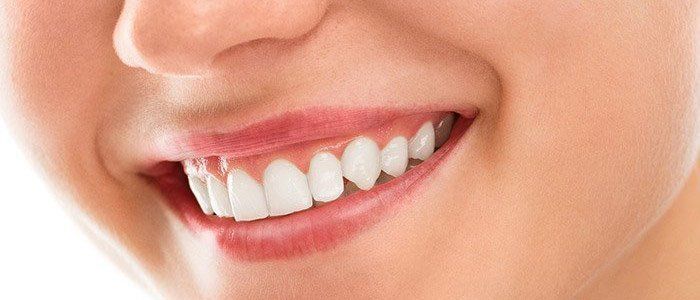 White teeth