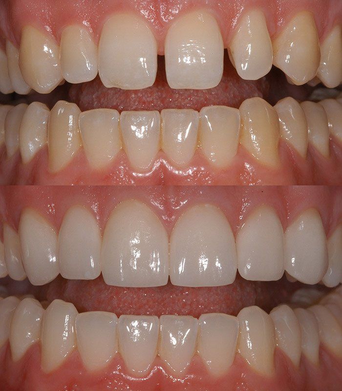 Lady repairing dummy teeth