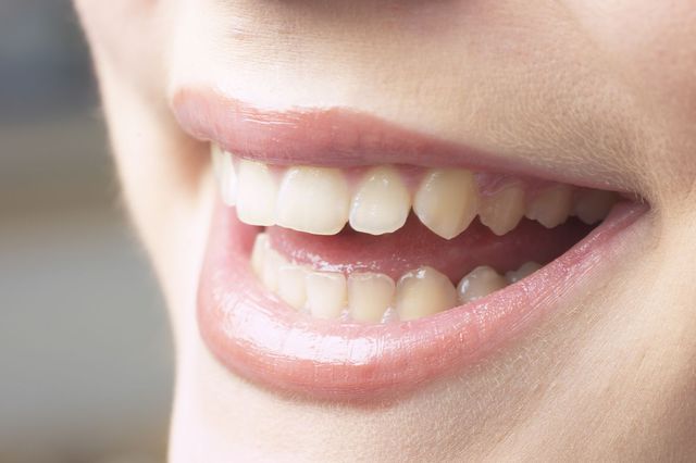 Healthy teeth