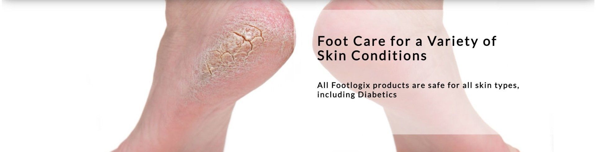 FOOTLOGIX NAIL SERVICES