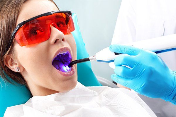 Root Canal Therapy — Urbana, IL — J. Barry Howell DDS Root Canal Therapy — Urbana, IL — J. Barry Howell DDS