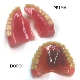 Visita dal dentista