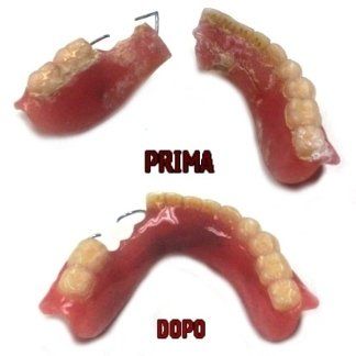 Dentiera riparata