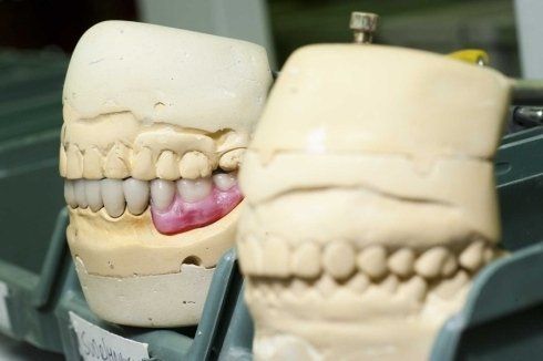 Calco dentale
