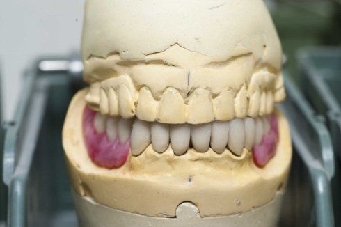 Pulizia dei denti