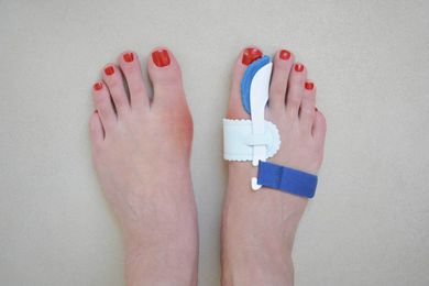Bunion — Feet Wearing Orthopedic Pads in Jackson, MI Bunion — Feet Wearing Orthopedic Pads in Jackson, MI