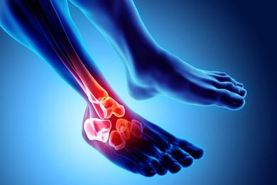 Arthritic Foot — Skeleton X-Ray in Jackson, MI Arthritic Foot — Skeleton X-Ray in Jackson, MI