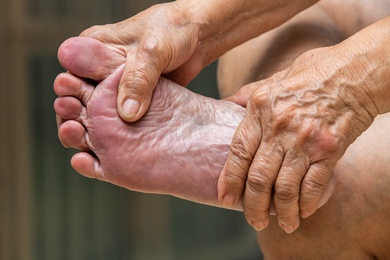 Warts — Elderly and their Feet in Jackson, MI Warts — Elderly and their Feet in Jackson, MI