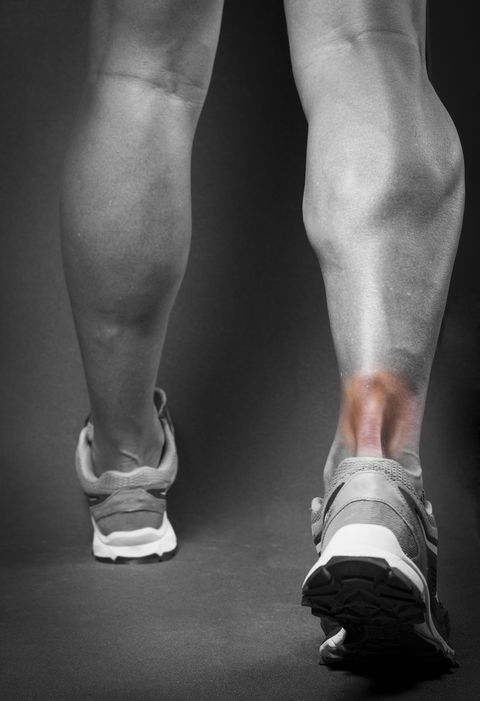 Arch Pain — Achilles Tendon in Jackson, MI Arch Pain — Achilles Tendon in Jackson, MI