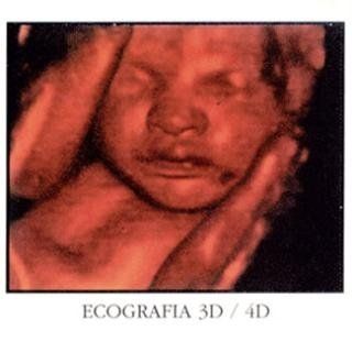 ecografia