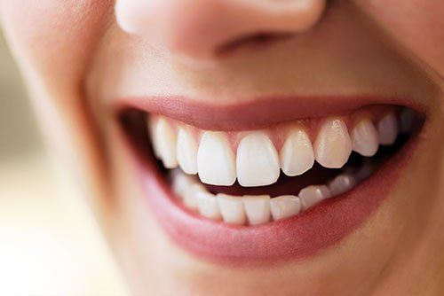 dental bridges in East Chapman Ave. Orange, CA