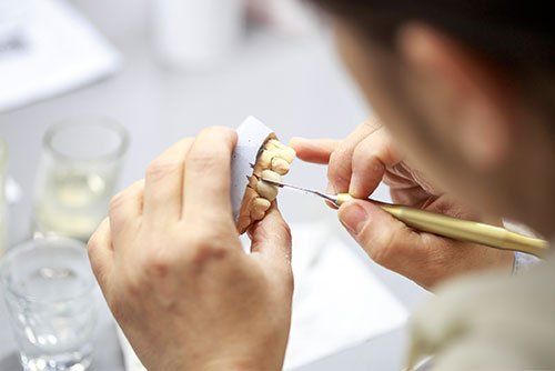 dental inlays and onlays, dentist in East Chapman Orange, CA