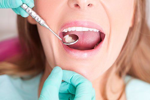 fluoride treatment in East Chapman Orange, California