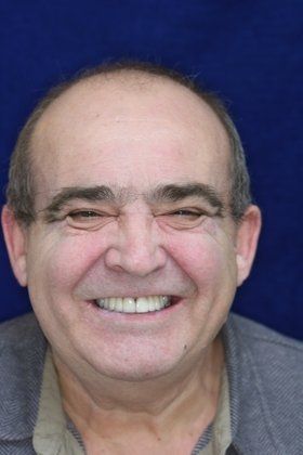 dental bridges Orange CA, patient at E.C.O. Dental, Orange CA Dentist