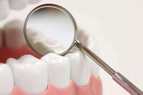 dental crowns in East Chapman Orange, CA