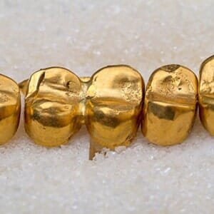 Picture Of Dental Gold— Jewelers in Ewing,NJ Picture Of Dental Gold— Jewelers in Ewing,NJ