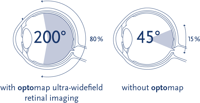 Retinal imaging with & without optomap