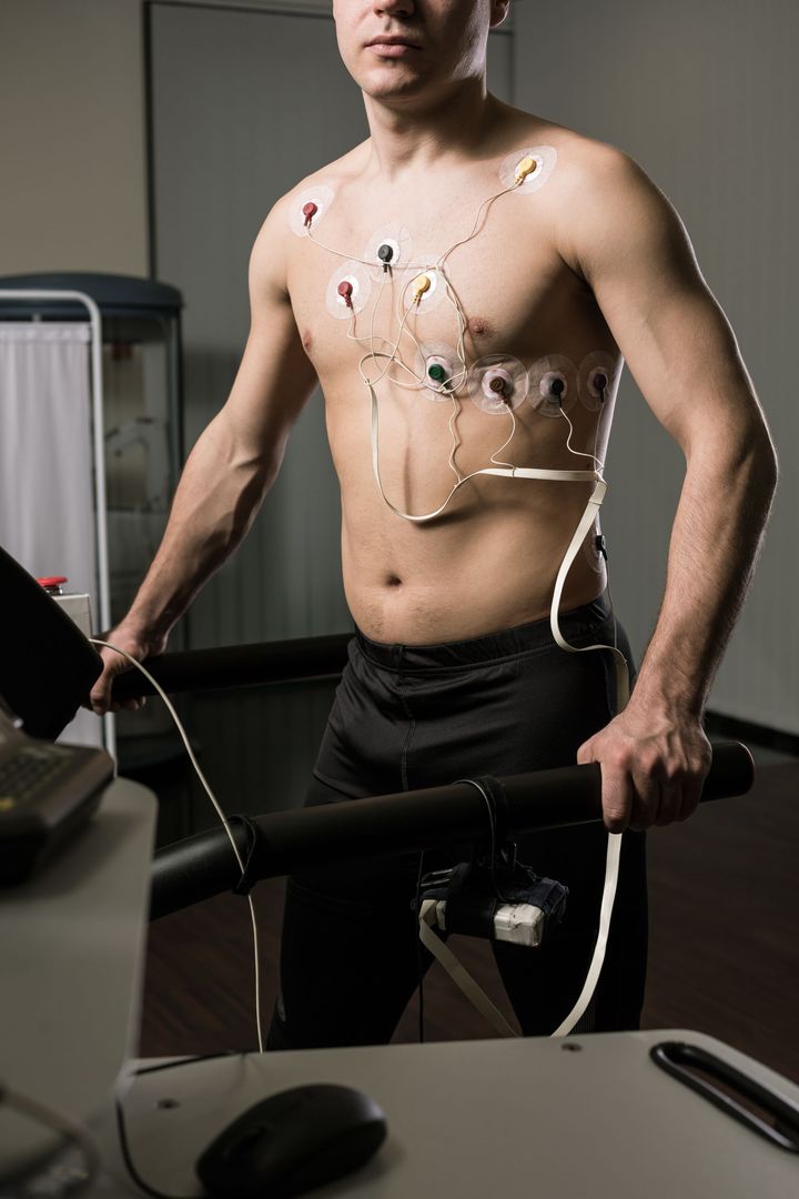 ECG post sforzo