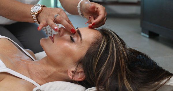 Acupuncture Near Me