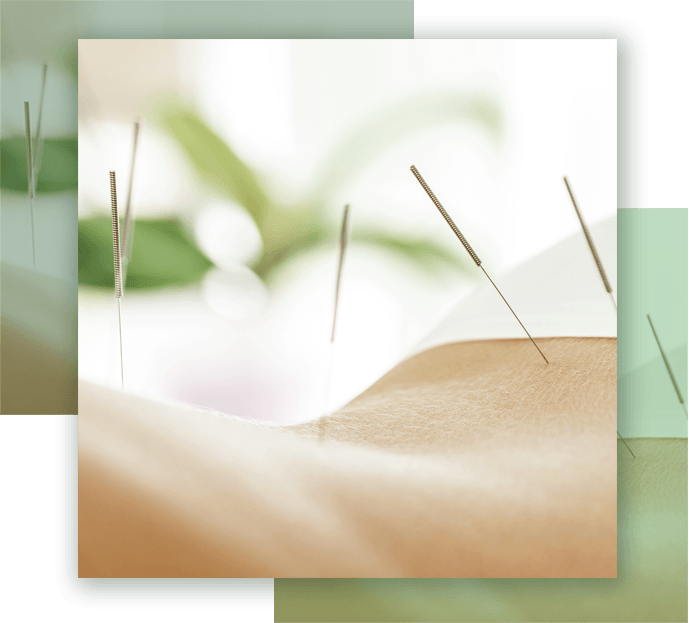 Acupuncture | Just Enjoy Life - Smithtown, NY