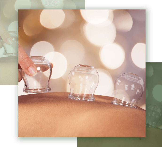 Cupping | Just Enjoy Life - Smithtown, NY