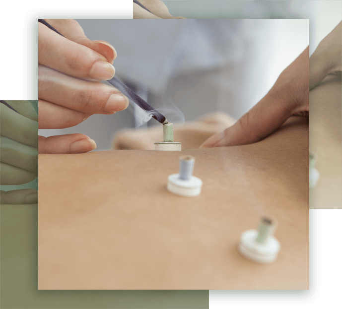 Moxibustion | Just Enjoy Life - Smithtown, NY