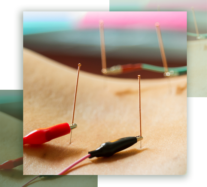 Electro Acupuncture | Just Enjoy Life - Smithtown, NY