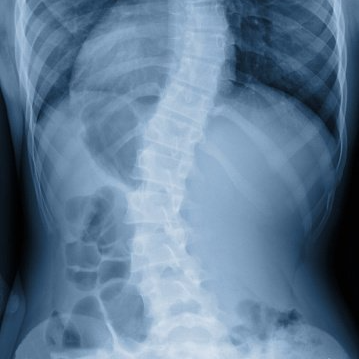 Xray — Chiropractic Care in Quakertown, PA