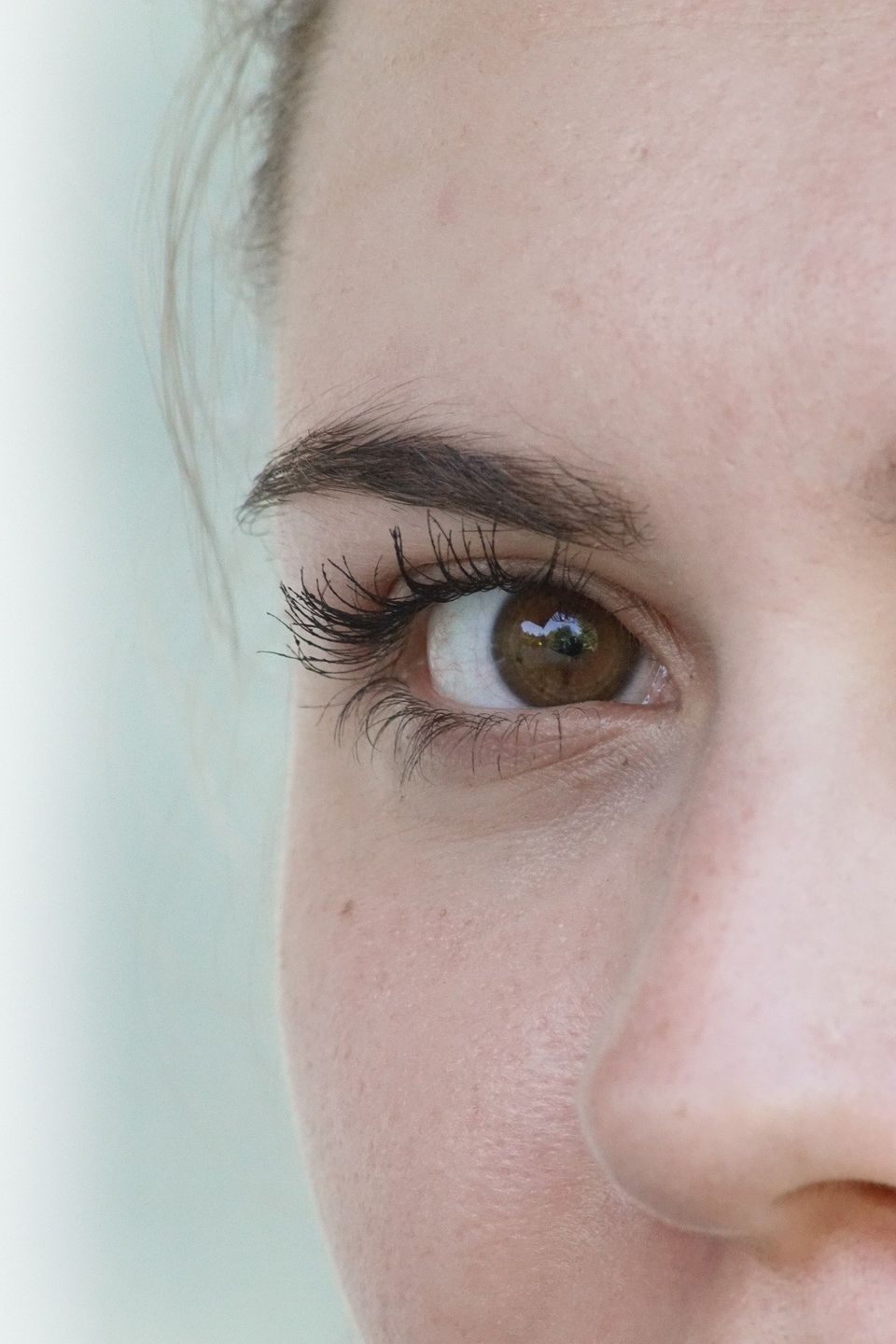 La mejor opción de tratamientos para glaucoma en Monterrey