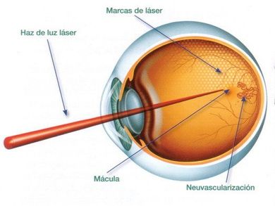 Tratamientos con láser Tratamientos con láser
