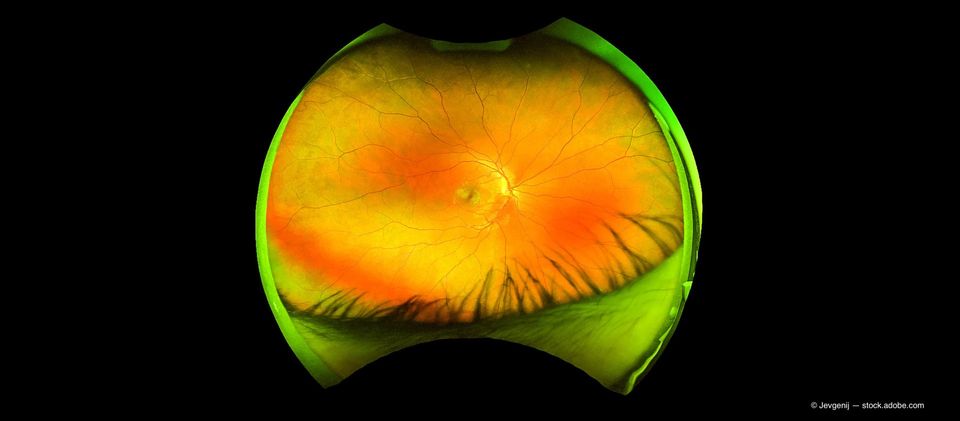 Cuidado continuo del glaucoma de ángulo abierto