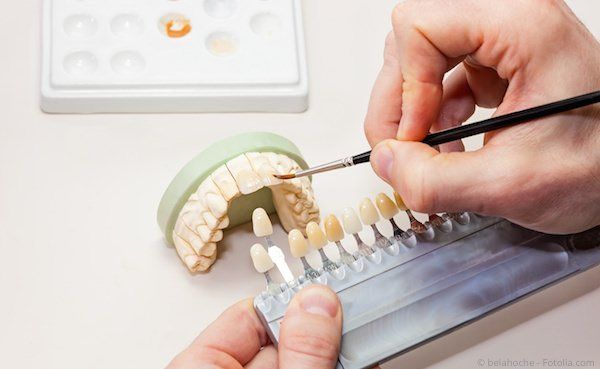 Ästhetische Zahngestaltung in unserem Praxislabor