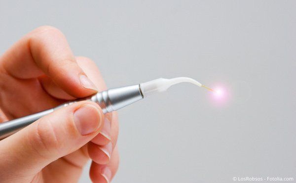 Schonende und sanfte Behandlung mit Laser-Licht