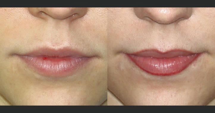 Lipstick — Woman with Red Lips in Worcester, MA