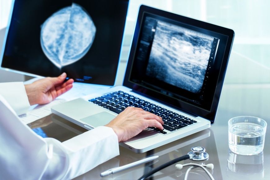 medico che analizza esito di una mammografia