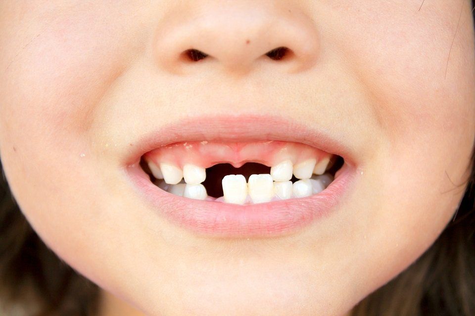 bambino con denti da latte