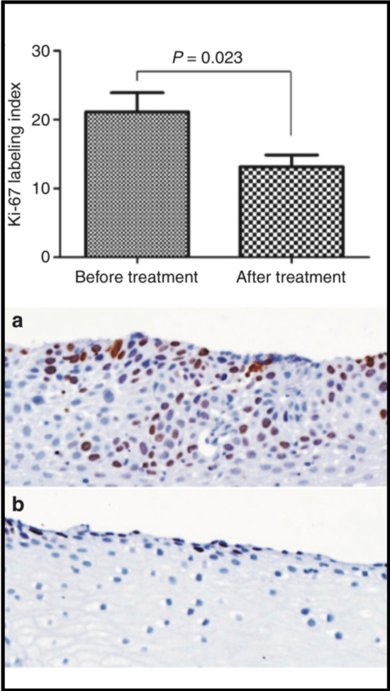 A graph showing the number of cells before and after treatment