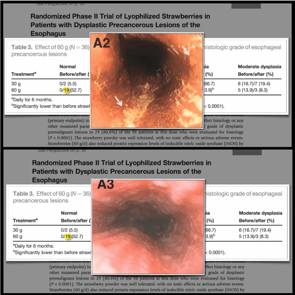 A picture of a stomach with the words randomized phase ii trial of lyophilized strawberries
