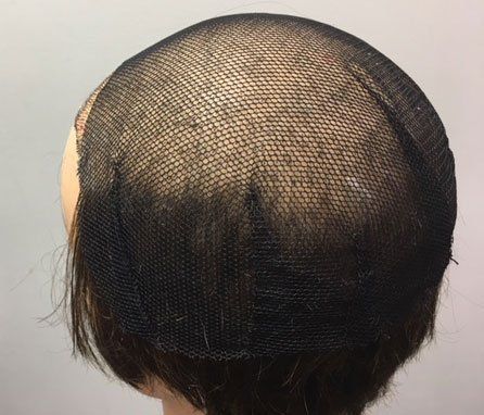Hair replacement & fitting consultancy