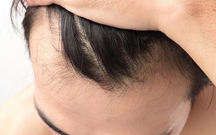 GLH Academy, Hair replacement & fitting consultancy course