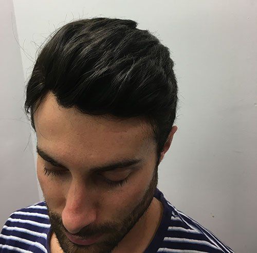 Hair replacement fitting and techniques