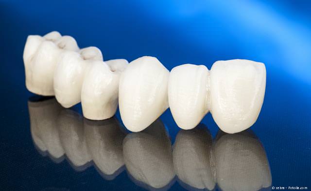 Dentaduras