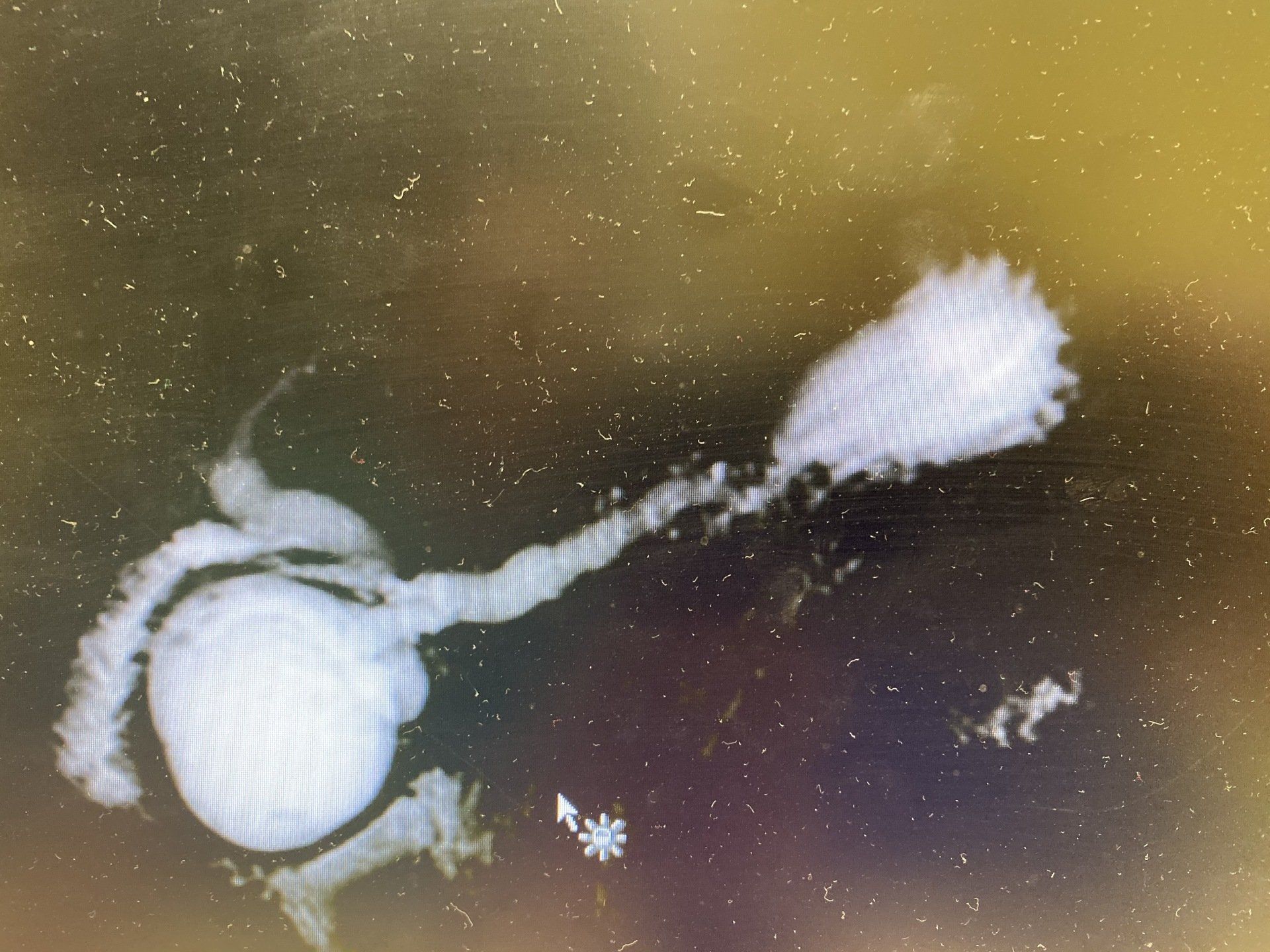 Endoscopic MRI image